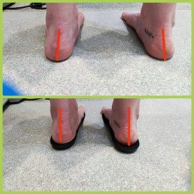 How orthotics correct problems