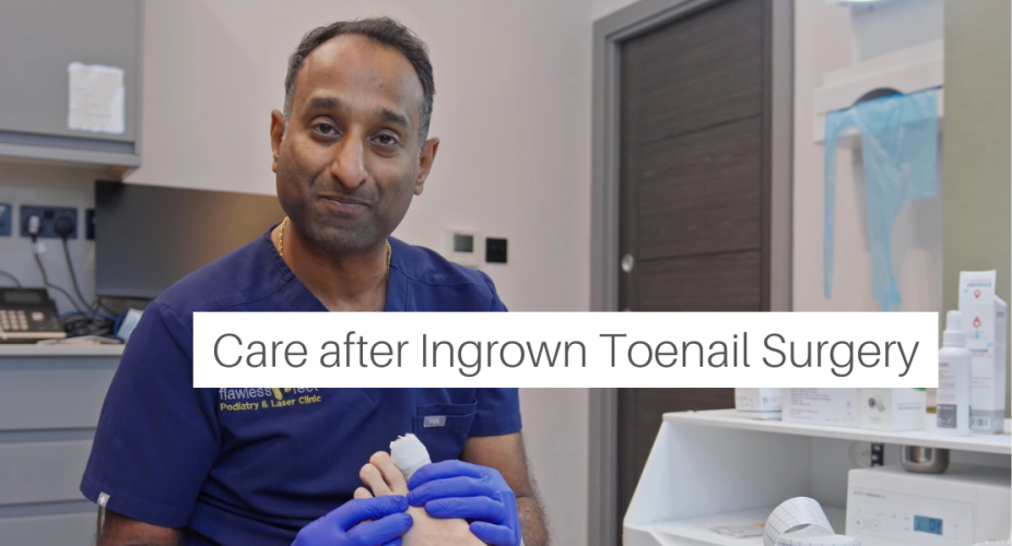 Care after Ingrown Toenail Surgery